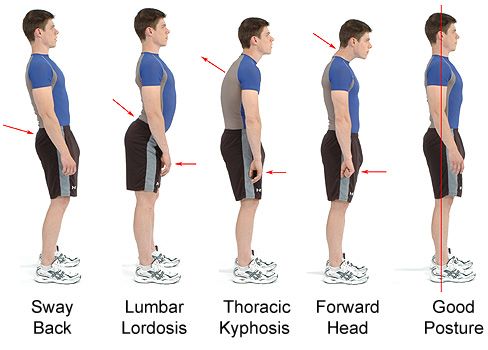 posture correction